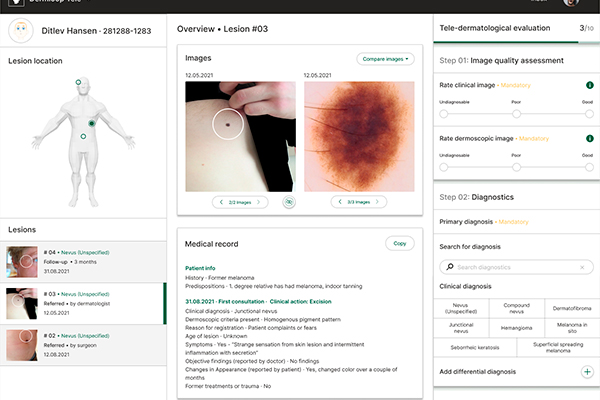 Melatech Melatech udvikler app, der skal nedbringe ventetiden for behandling af ...